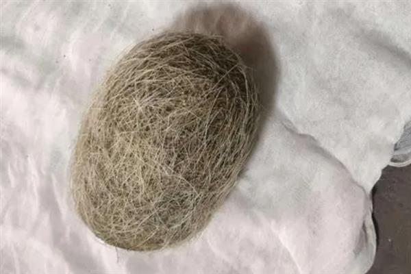 猪砂是猪的哪个位置，在猪胆囊、胆管、肝管等脏器中