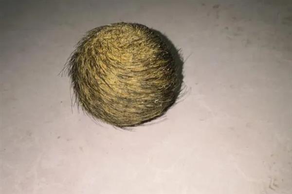 猪砂是猪的哪个位置，在猪胆囊、胆管、肝管等脏器中