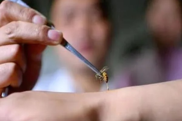 被蜜蜂蛰了如何解决，拔出毒刺再用肥皂水清洗伤口