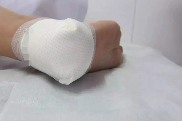 被蜜蜂蛰了如何解决，拔出毒刺再用肥皂水清洗伤口