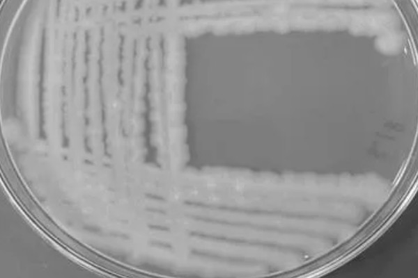 脱氧雪腐镰刀菌烯醇的副作用，会导致动物食欲下降、体重减轻等