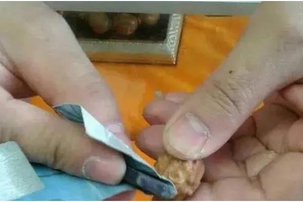 橄榄核裂了还能盘回来吗，取决于开裂程度