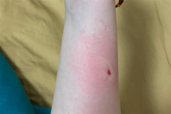 打死一只马蜂会不会报复,可能会遭到报复