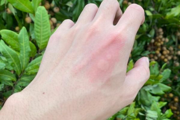 小黄腰胡蜂有没有毒，属于常见的剧毒胡蜂