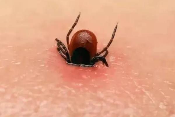 什么是蜱虫，也叫壁虱、扁虱、草爬子等
