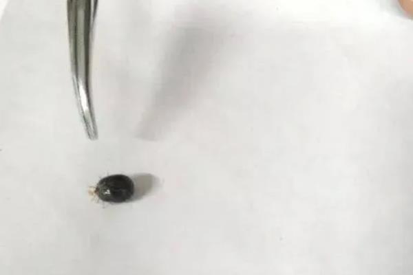 什么是蜱虫，也叫壁虱、扁虱、草爬子等