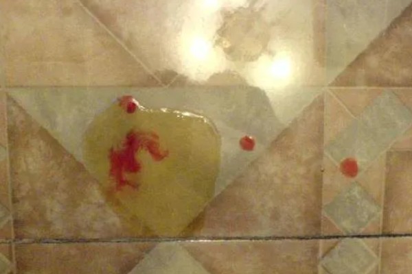 公狗尿道口流出脓液的原因，可能正处于发情期