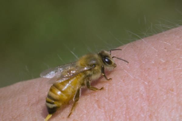 蜂毒会引起过敏的原因,免疫系统对蜂毒很敏感