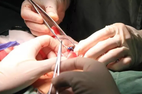 珍珠的培育方式，主要以马氏贝、白蝶贝培育为主