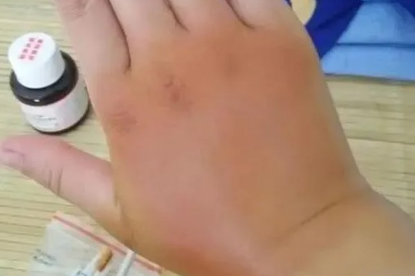 引诱马蜂怎么配制诱蜂水,要将蜂王作为药引