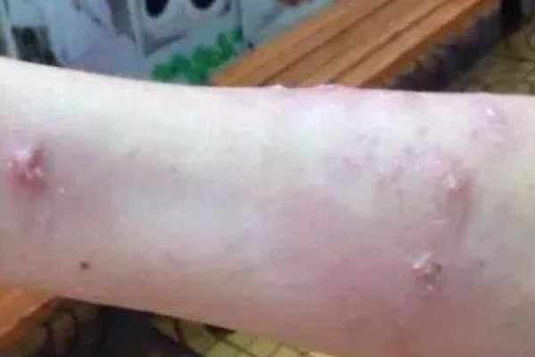蚂蚁的危害，会损坏设施和传播疾病